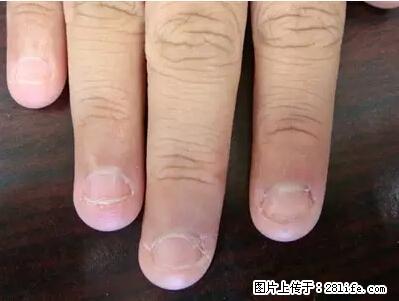 剪指甲、挖耳屎，这些日常小动作竟隐藏大危害！ - 重庆生活资讯 - 重庆28生活网 cq.28life.net